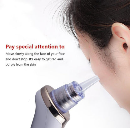 Electric Blackhead Remover & Pore Vacuum Cleansing Device (view 10)