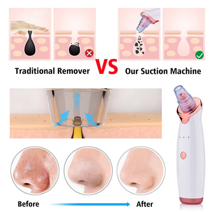 Electric Blackhead Remover & Pore Vacuum Cleansing Device (view 8)
