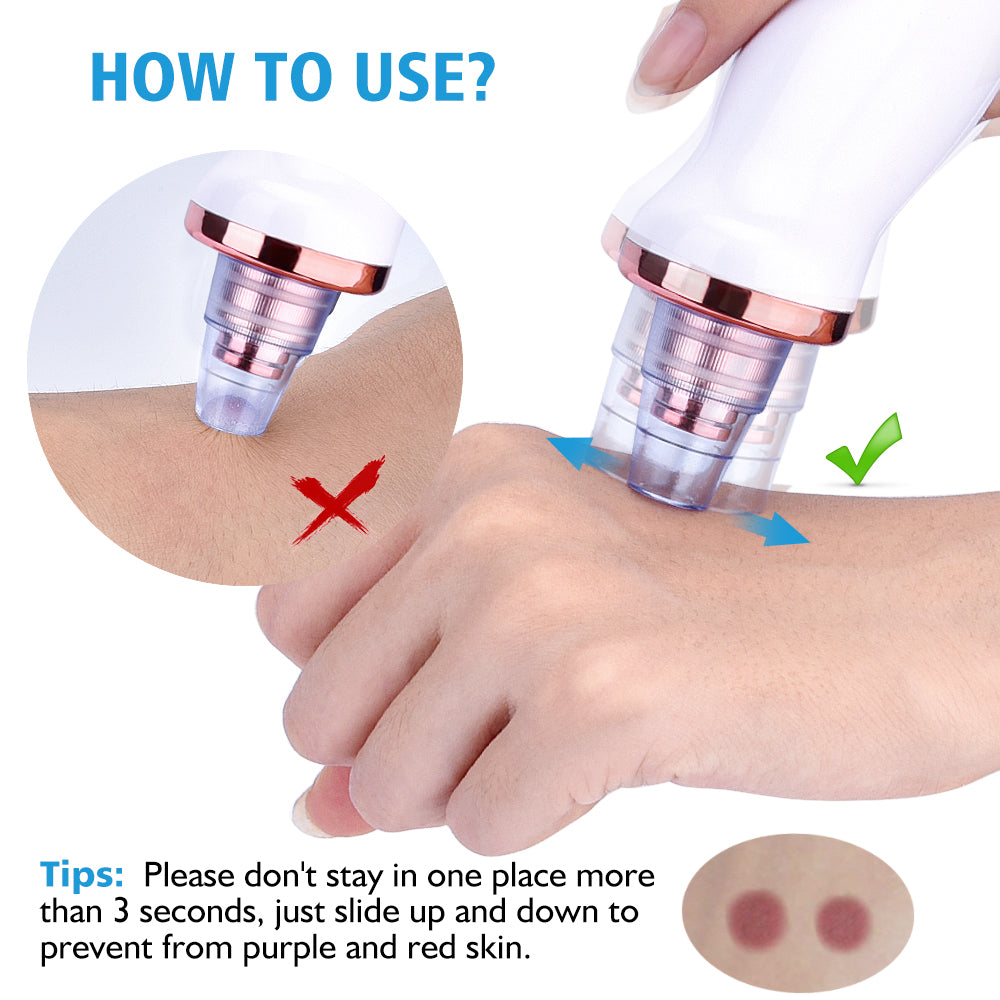 Electric Blackhead Remover & Pore Vacuum Cleansing Device (view 3)