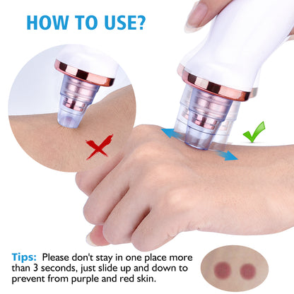 Electric Blackhead Remover & Pore Vacuum Cleansing Device (view 3)