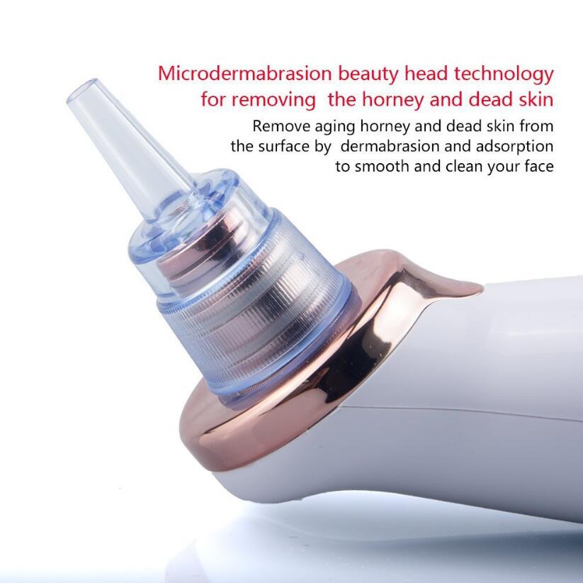 Electric Blackhead Remover & Pore Vacuum Cleansing Device (view 2)