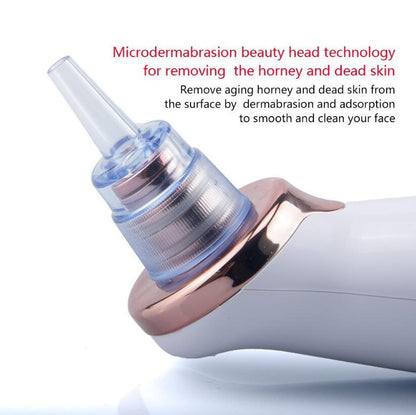 Electric Blackhead Remover & Pore Vacuum Cleansing Device (view 2)